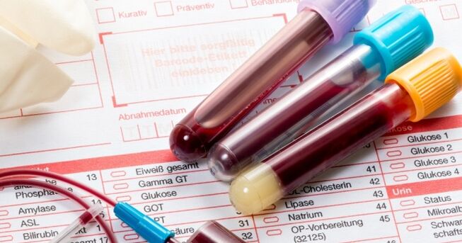 Examen de sangre para el virus del papiloma humano